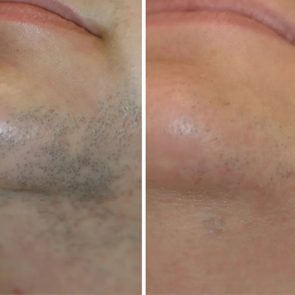Nora Skin™ | Haargroeiremmend Serum