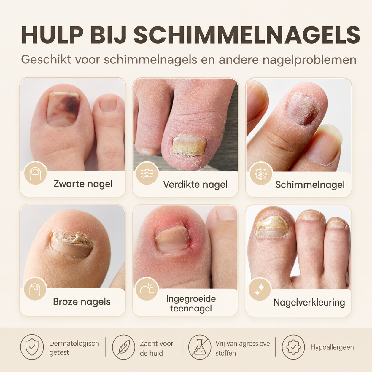KalkPatches™ | Behandel Kalknagels In Je Slaap