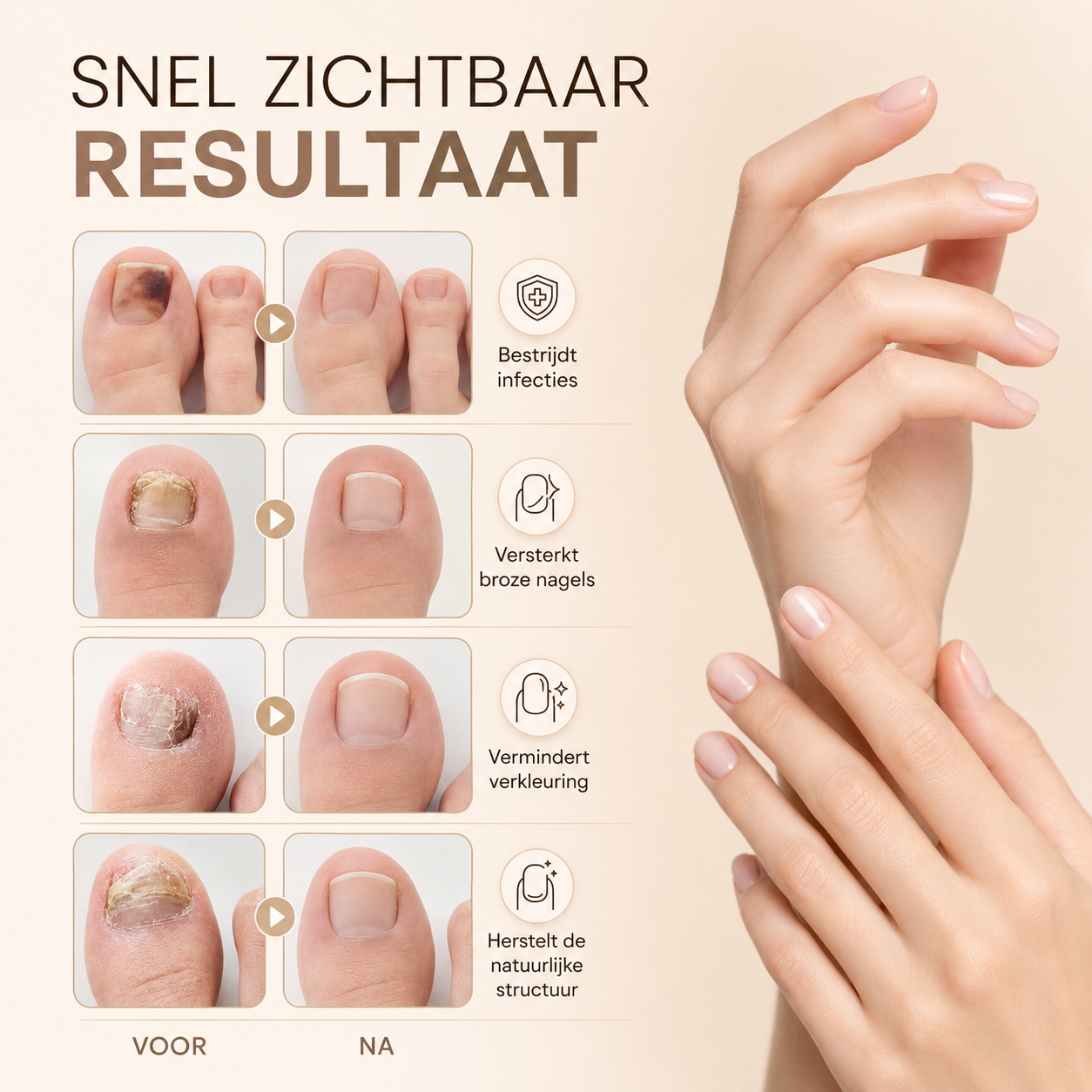 KalkPatches™ | Behandel Kalknagels In Je Slaap