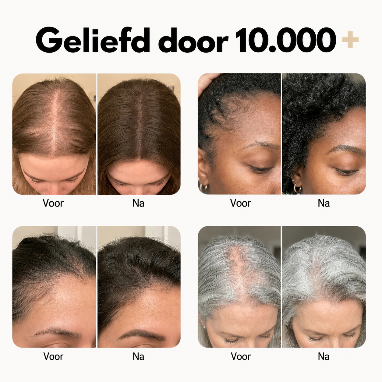 NoraSkin™ | Hair Growth Serum
