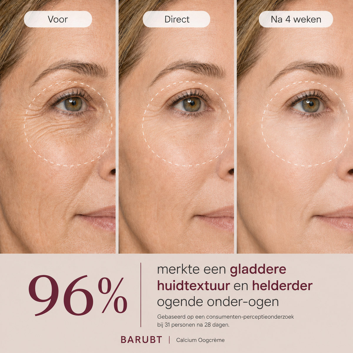 NoraSkin™ | Korean Calcium Dark Spot Eye Cream