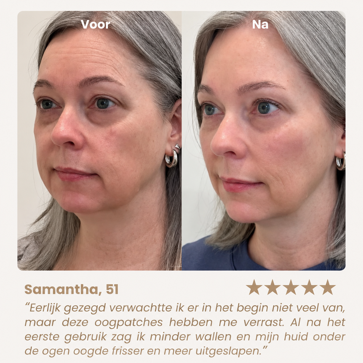PeptiEyes™ | Collageen Hydrogel Oogpatches