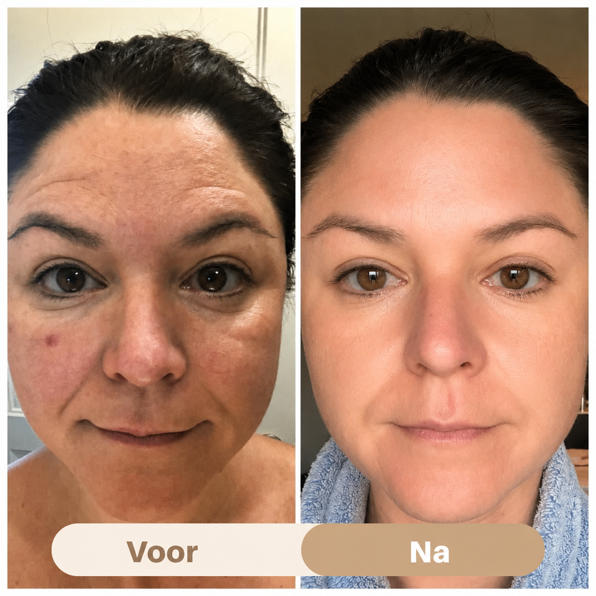 PeptiEyes™ | Collageen Hydrogel Oogpatches