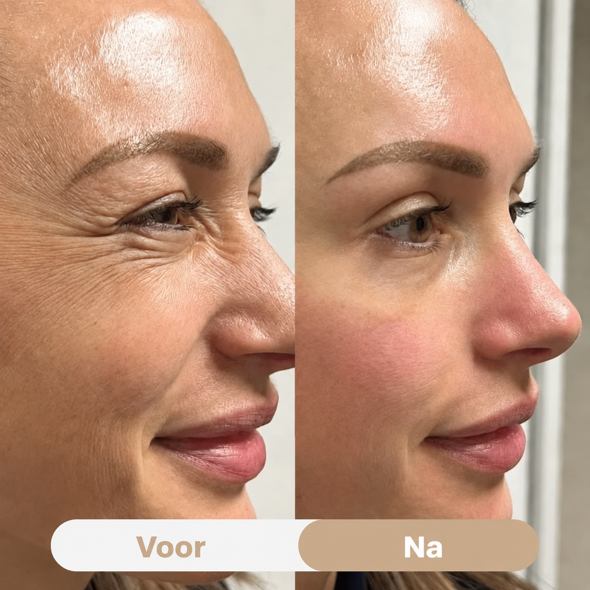 PeptiEyes™ | Collageen Hydrogel Oogpatches