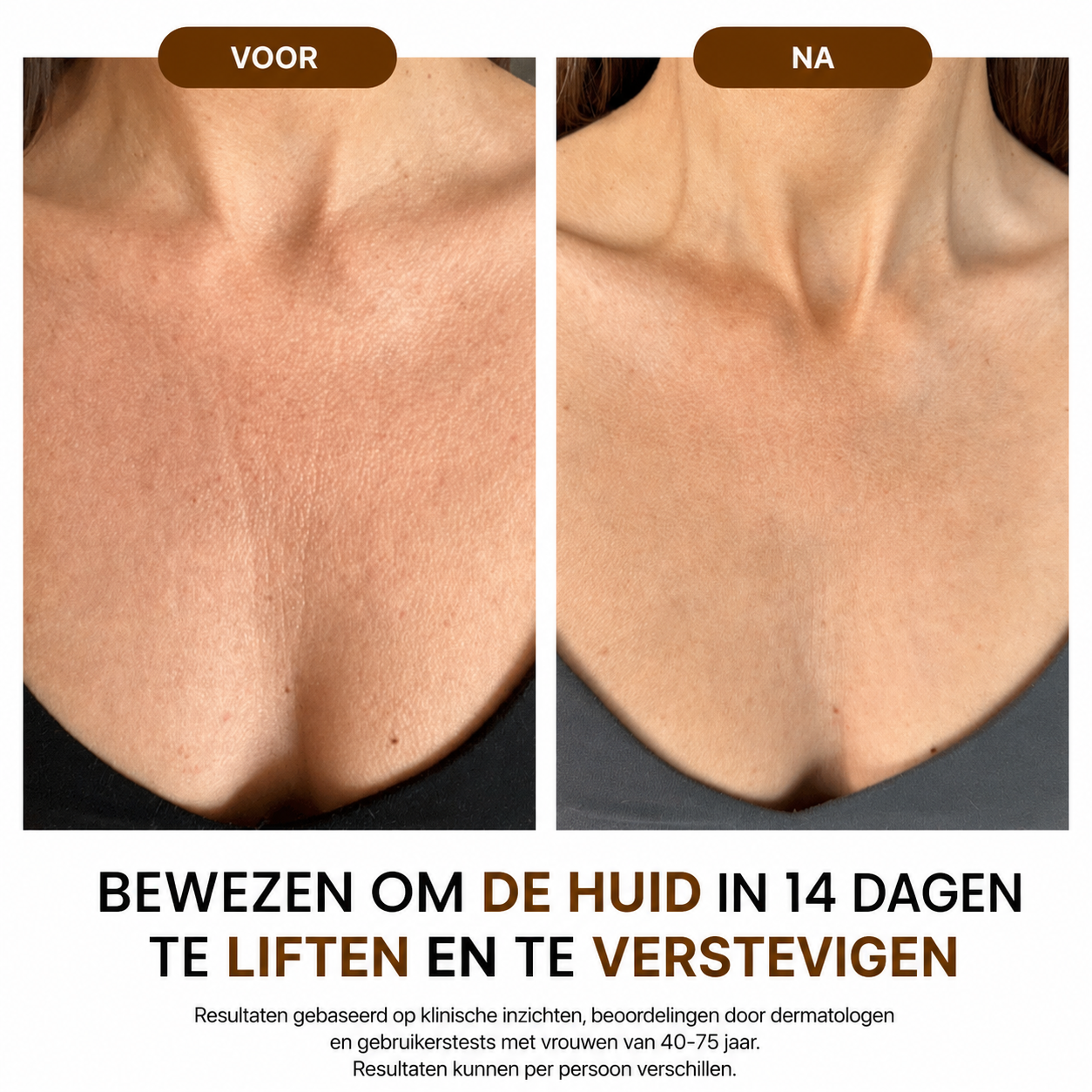 NoraSkin™ | Silk Body Oil