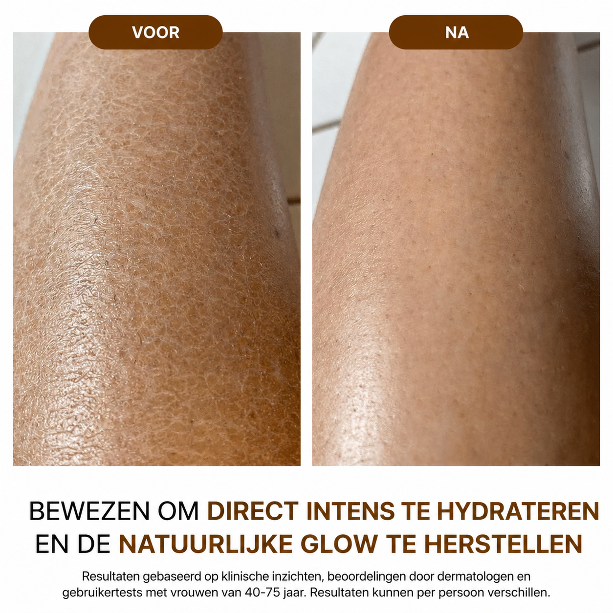 NoraSkin™ | Silk Body Oil