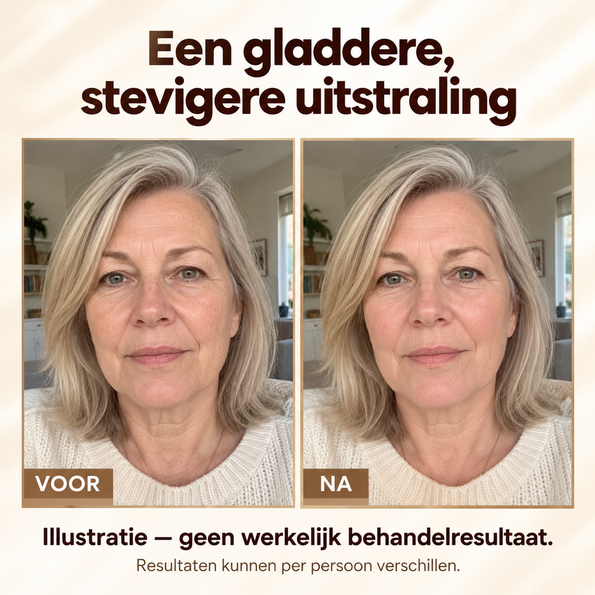 SkinLift™ | 3D-peptidecrème voor een steviger, voller ogende huid