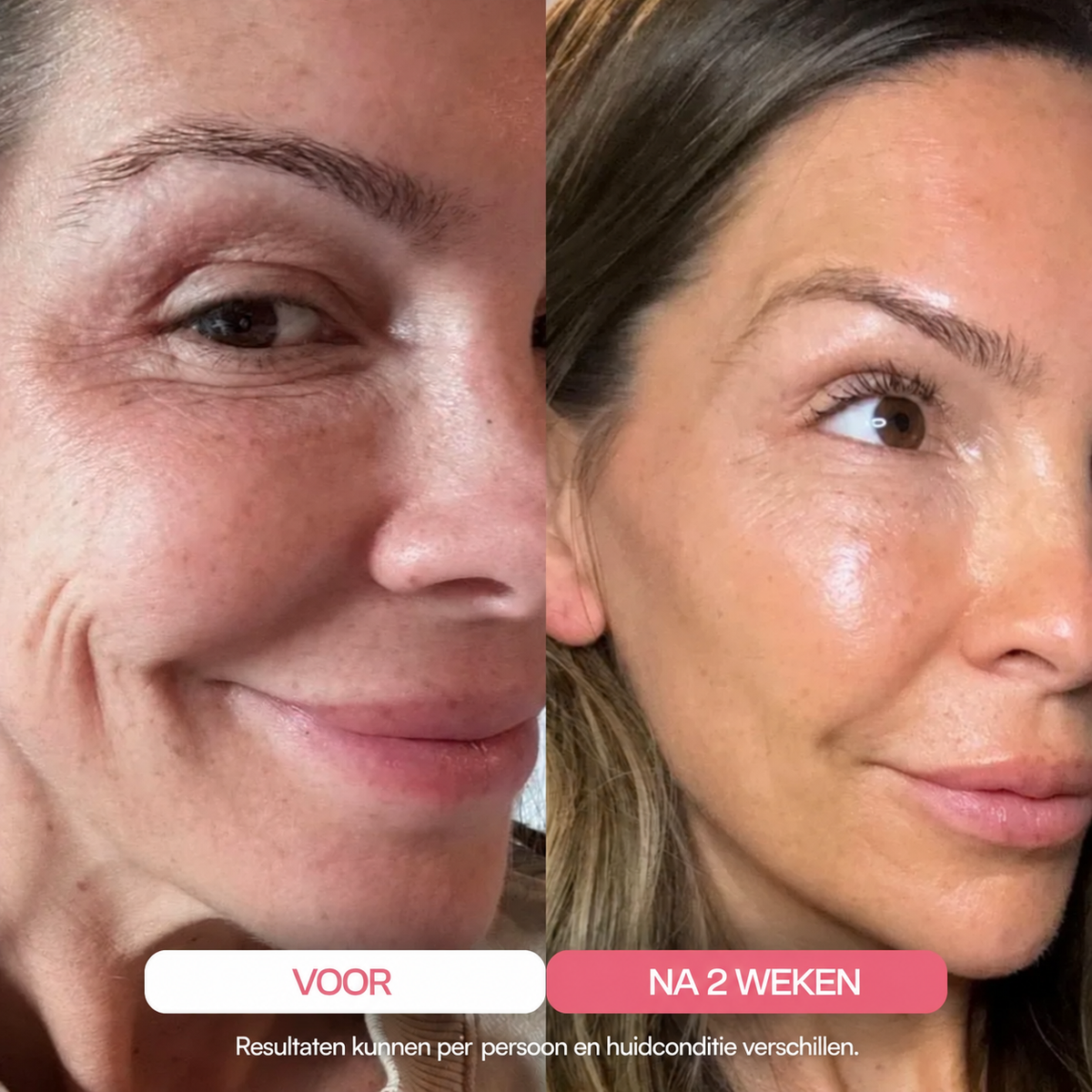 BeautyWrap™ | Ultra-absorbeerbaar collageenmasker