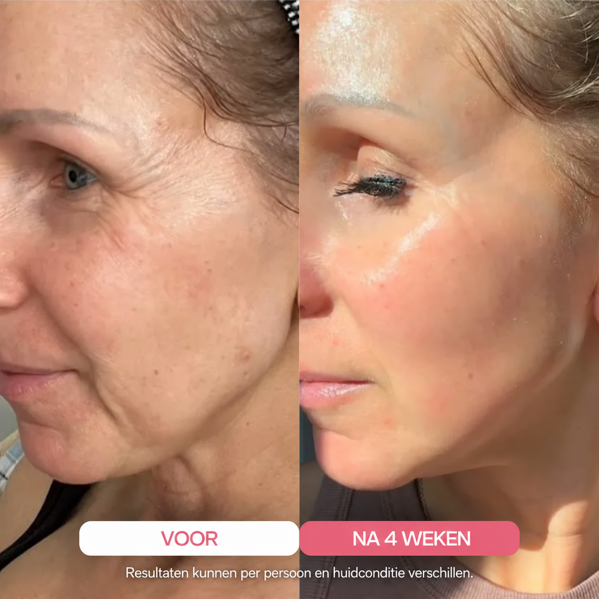 BeautyWrap™ | Ultra-absorbeerbaar collageenmasker