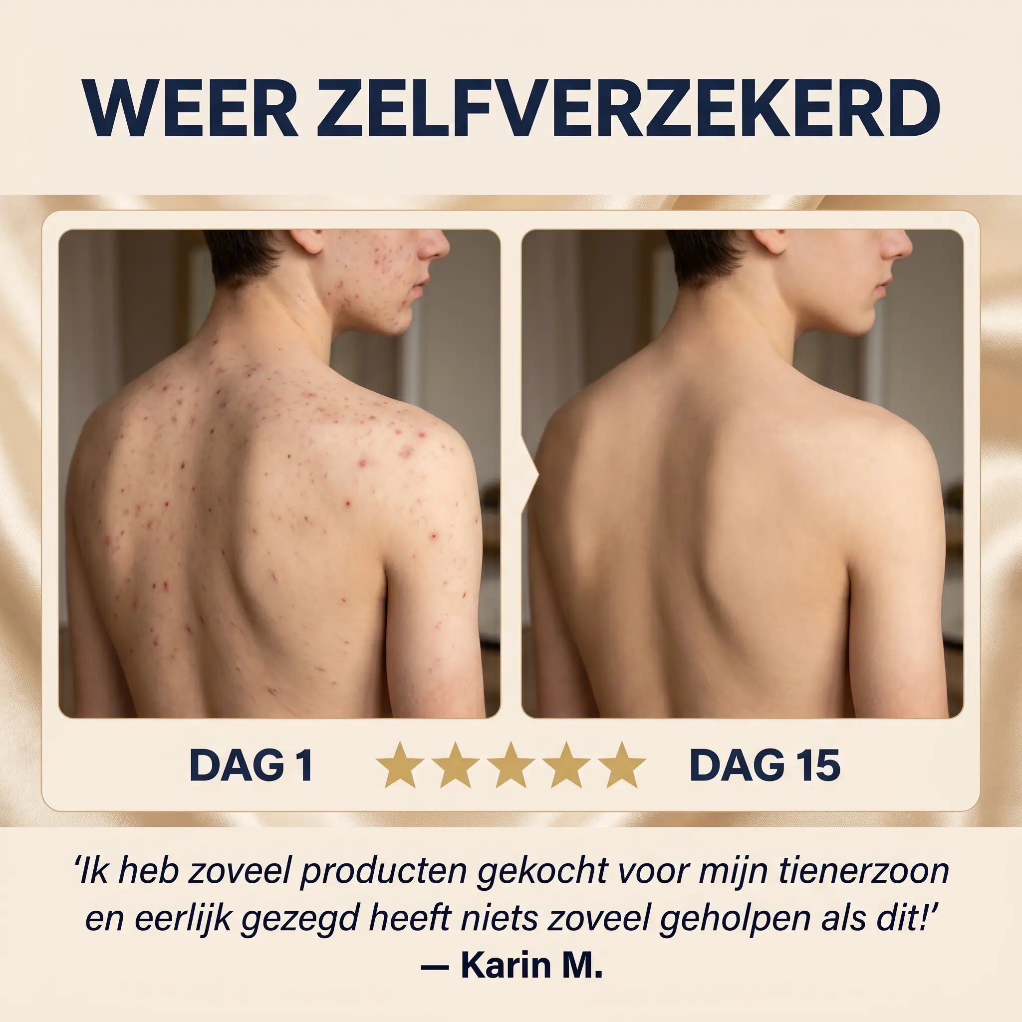 Bacne Bar™ | Maak Een Einde Aan Rug Acne