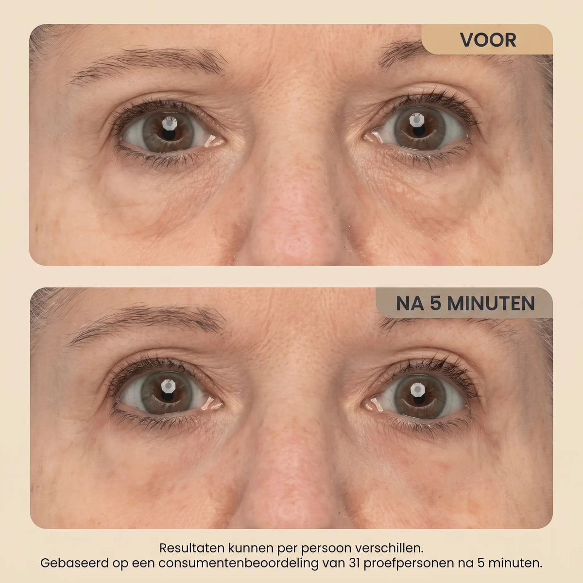 Instant Lift Eye Gel