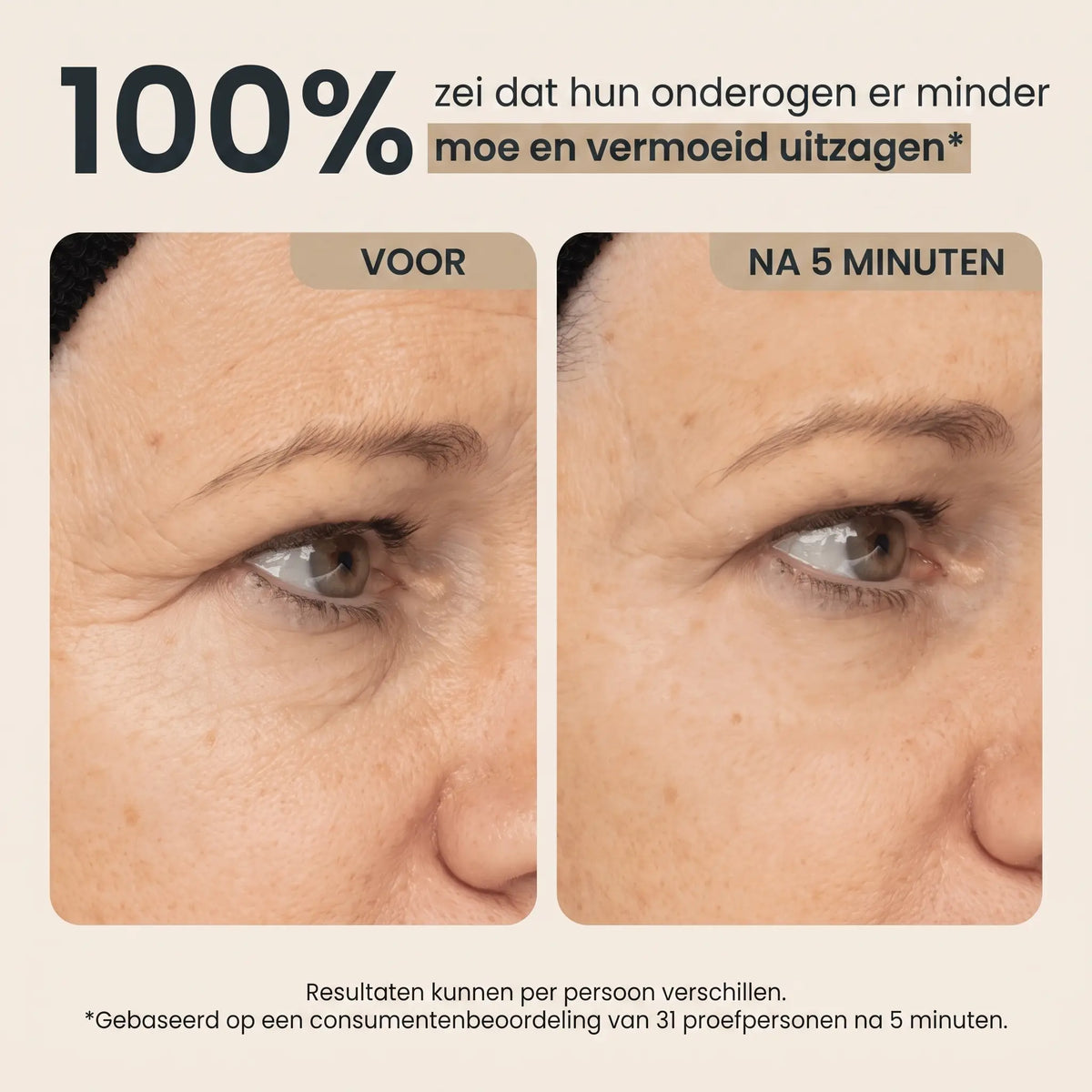 Instant Lift Eye Gel