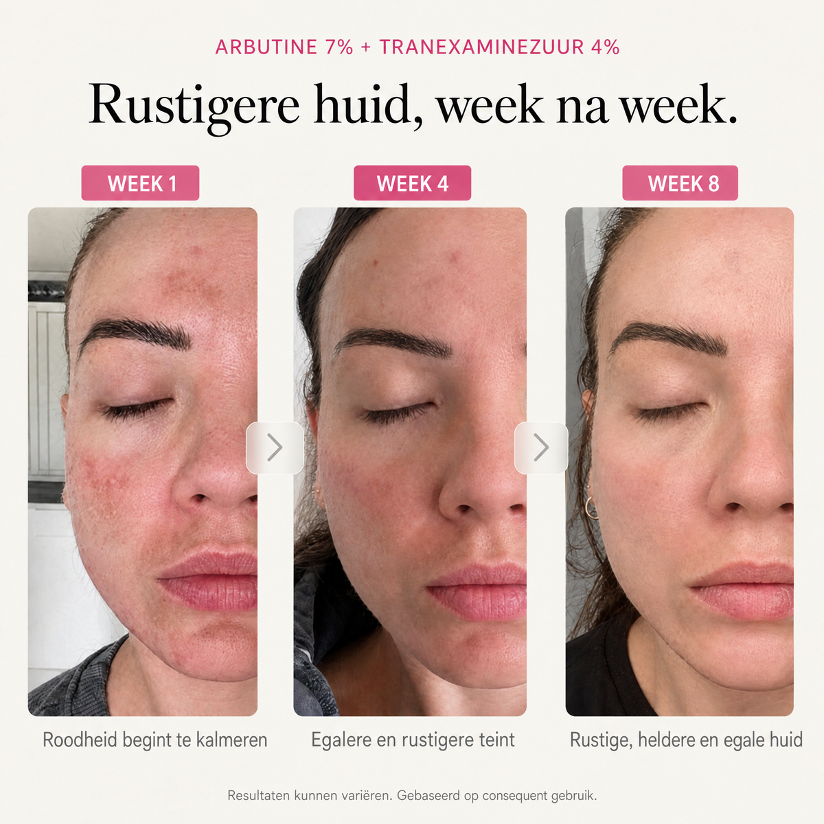 Rustigere huid, week na week