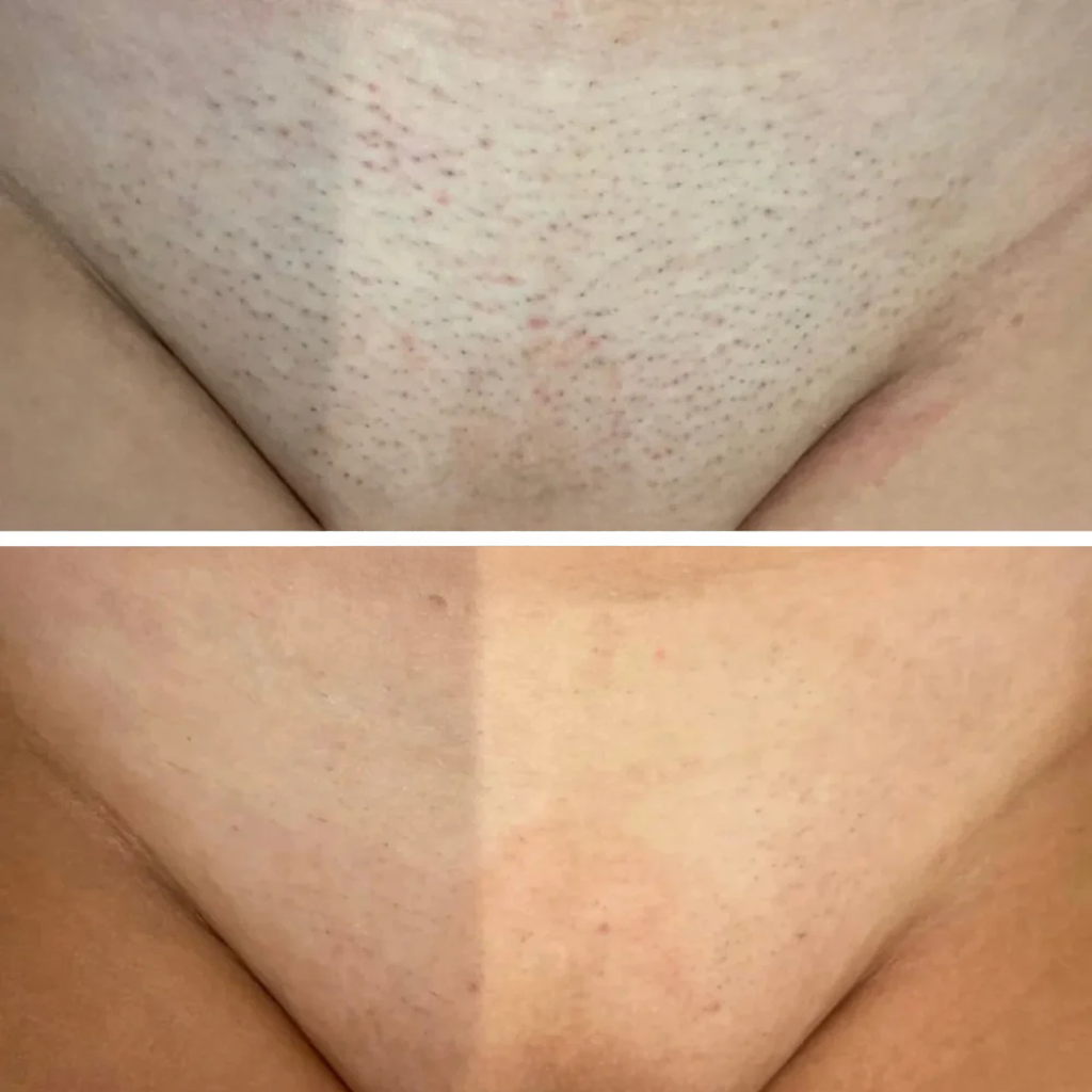 Nora Skin™ | Haargroeiremmend Serum