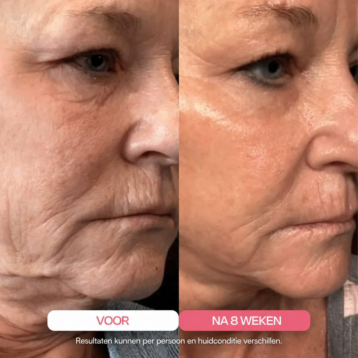 BeautyWrap™ | Ultra-absorbeerbaar collageenmasker