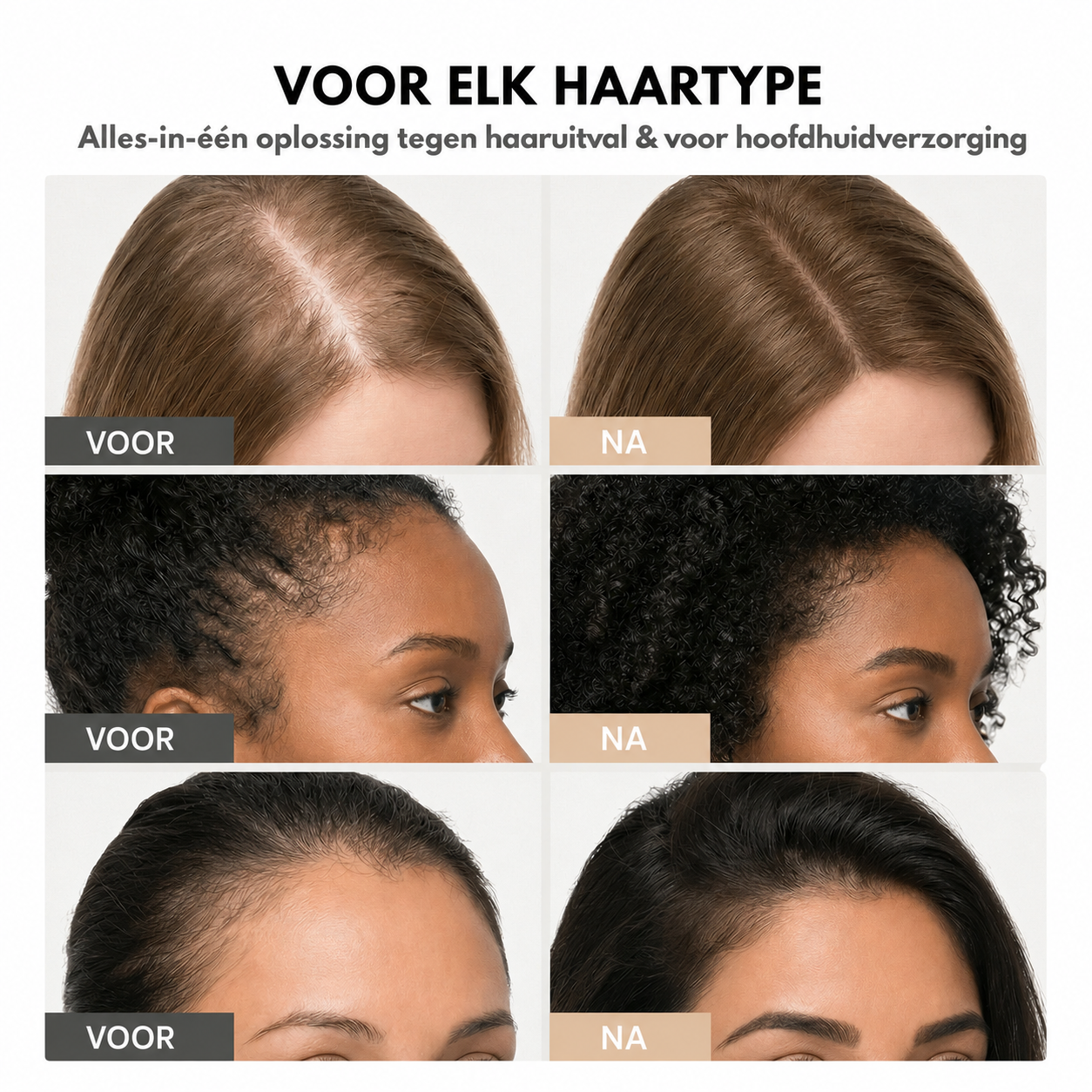 NoraSkin™ | Hair Growth Serum