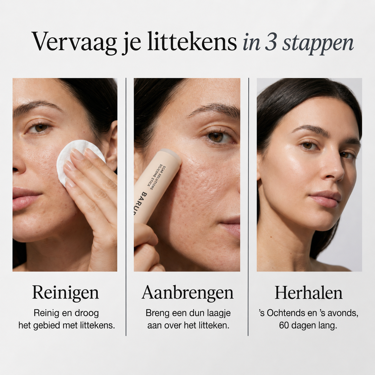 ScarStick™ | Voor acnelittekens, operatiescars en striae. Klinische werking, thuis