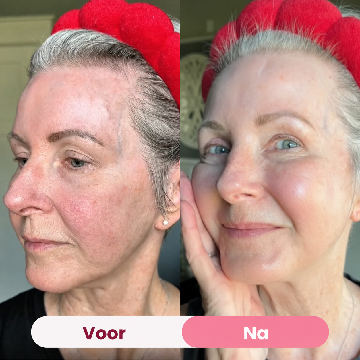 HydraMask™ | Intensief hydraterend bio-collageenmasker