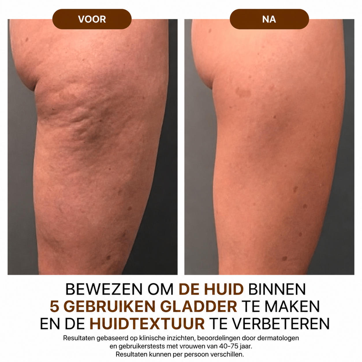 NoraSkin™ | Silk Body Oil