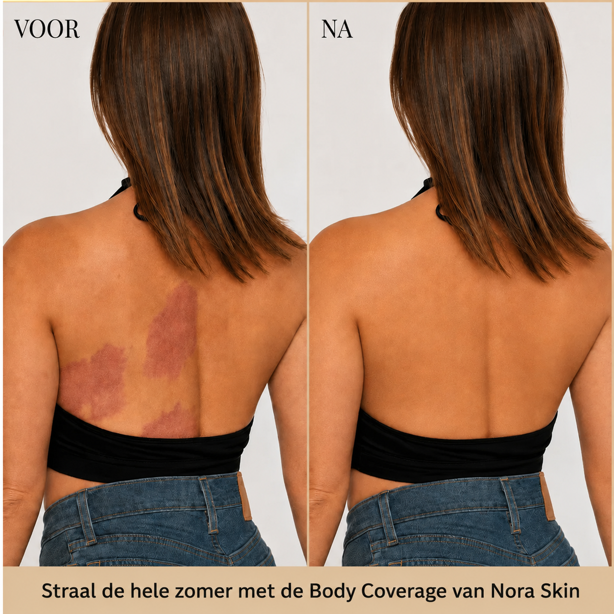 NoraSkin™ Body Coverage Concealer