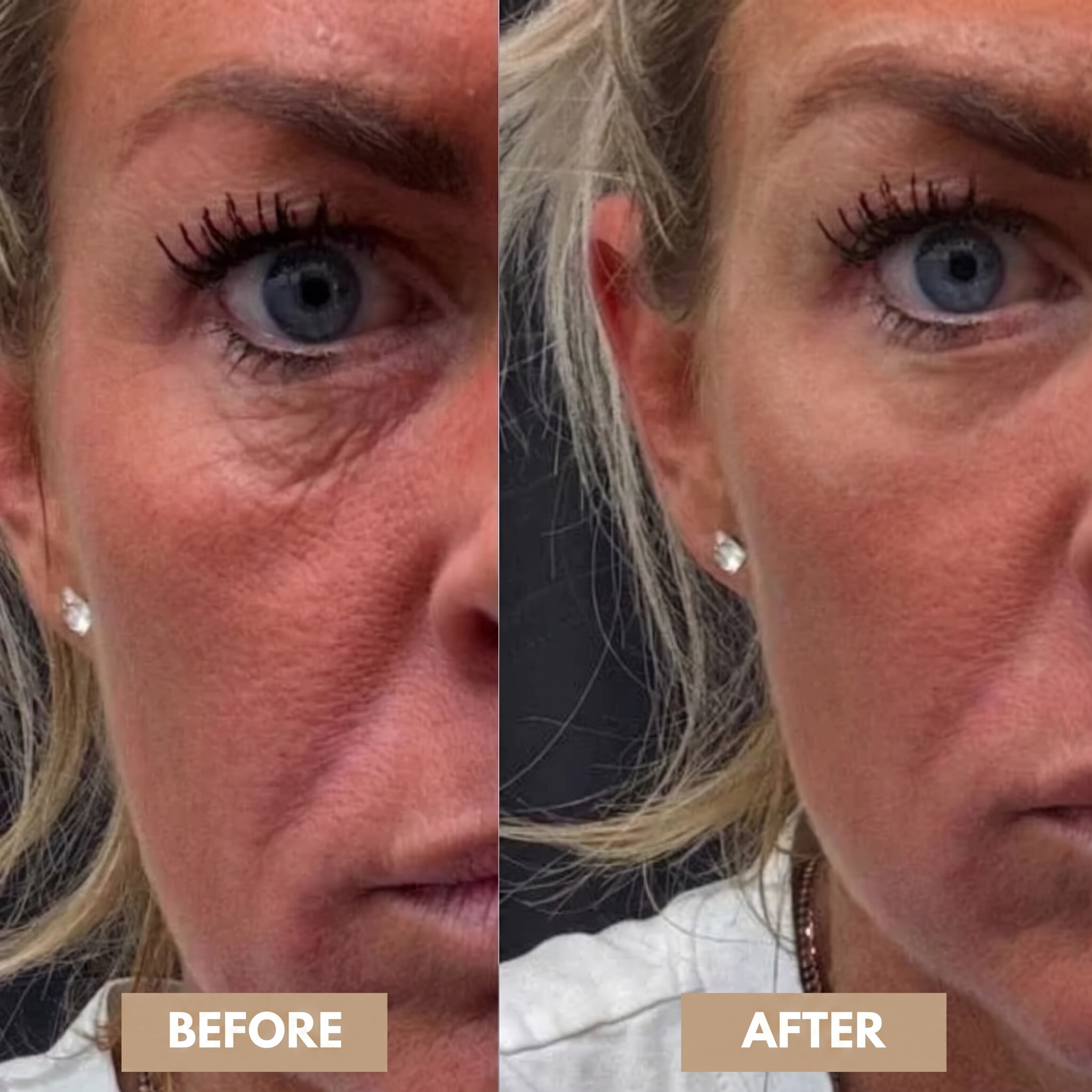 PeptiEyes™ | Collageen Hydrogel Oogpatches