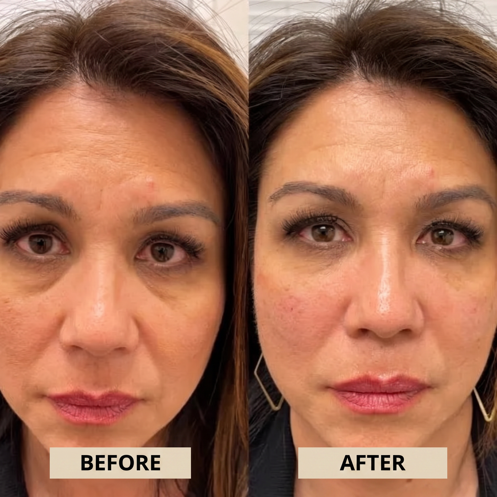 PeptiEyes™ | Collageen Hydrogel Oogpatches