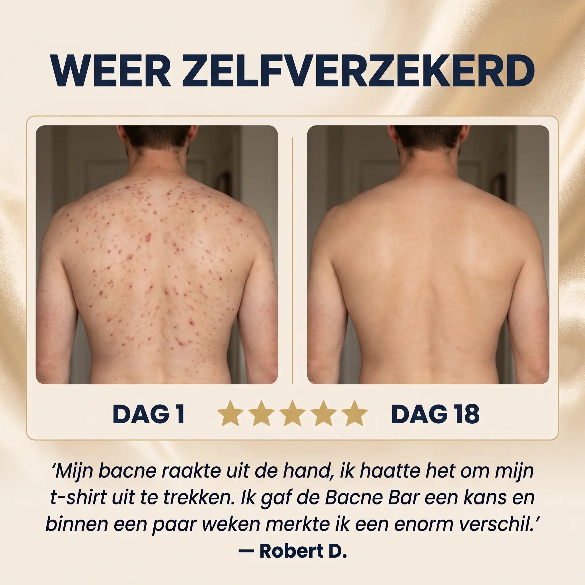 Bacne Bar™ | Maak Een Einde Aan Rug Acne