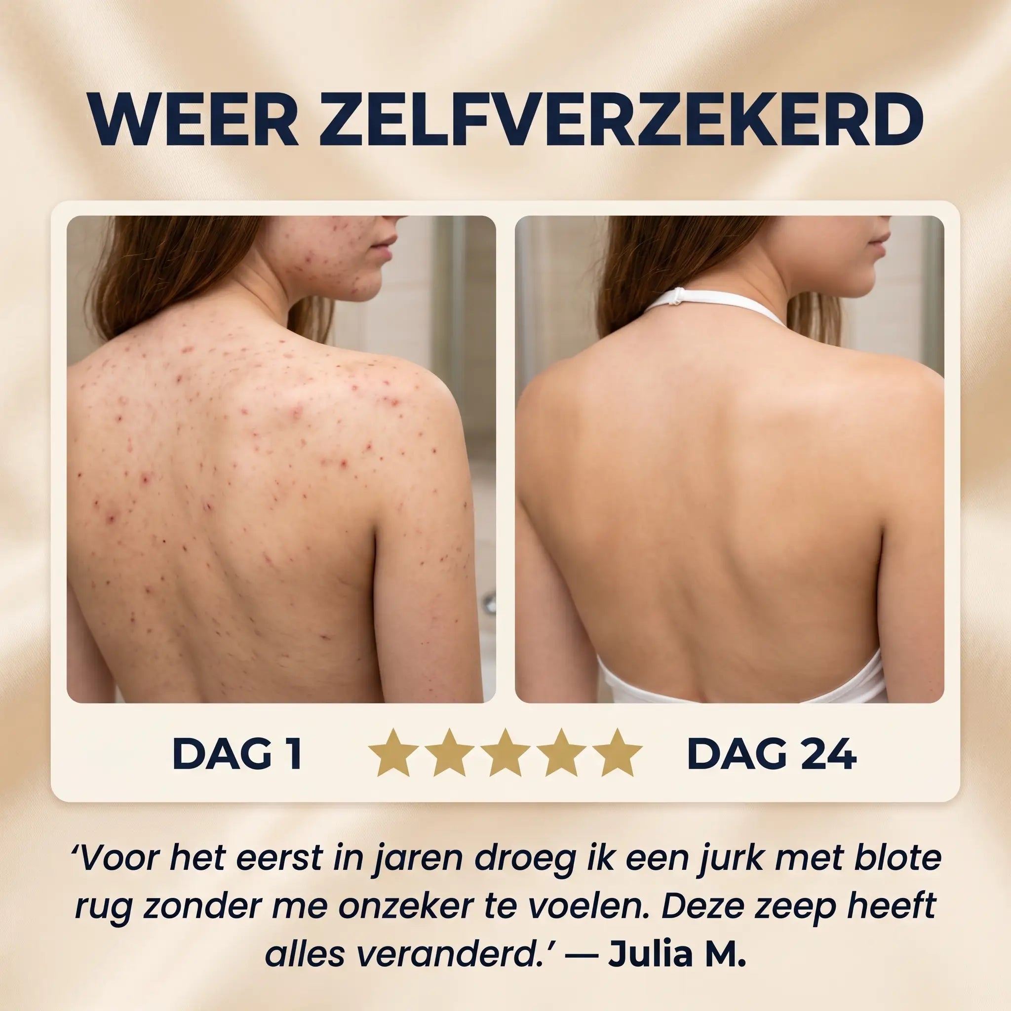 Bacne Bar™ | Maak Een Einde Aan Rug Acne