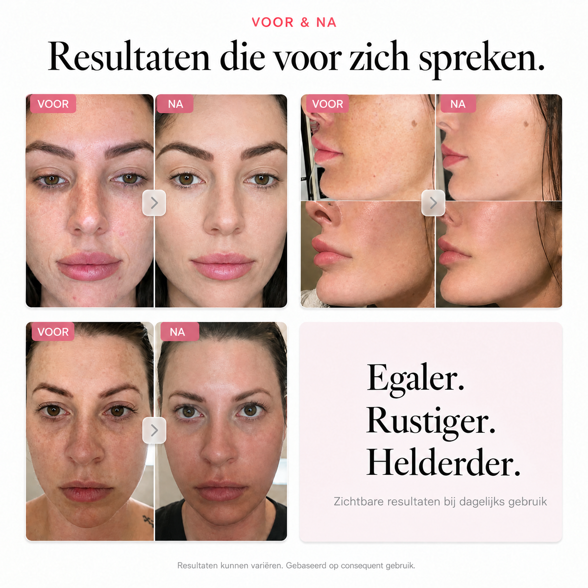 Resultaten die voor zich spreken